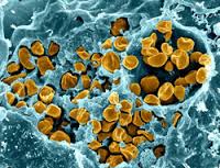 Cryptococcus Cryptococcus gattii